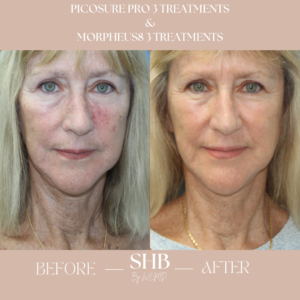 picosure services wayne lee md