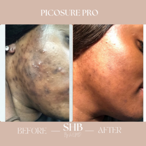 picosure services wayne lee md